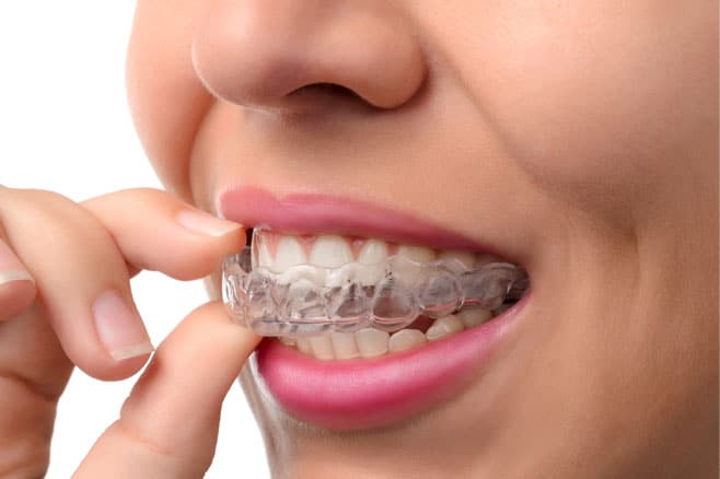 Invisalign Bridgewater NJ