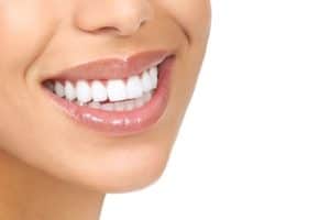 invisalign in bridgewater nj