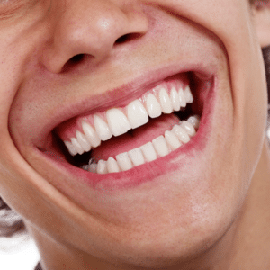 invisalign teen bridgewater nj