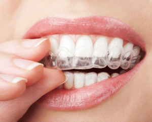 invisalign orthodontics