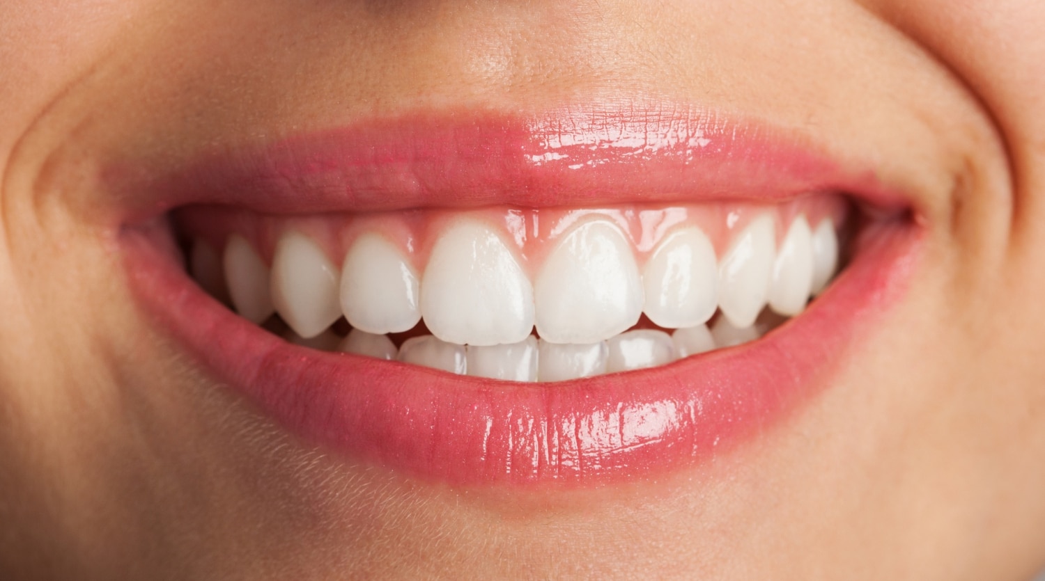 Teeth Whitening in New Jersey: How to Get the Treatment